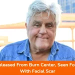 Jay Leno Released From Burn Center, Seen For First Time With Facial Scar
