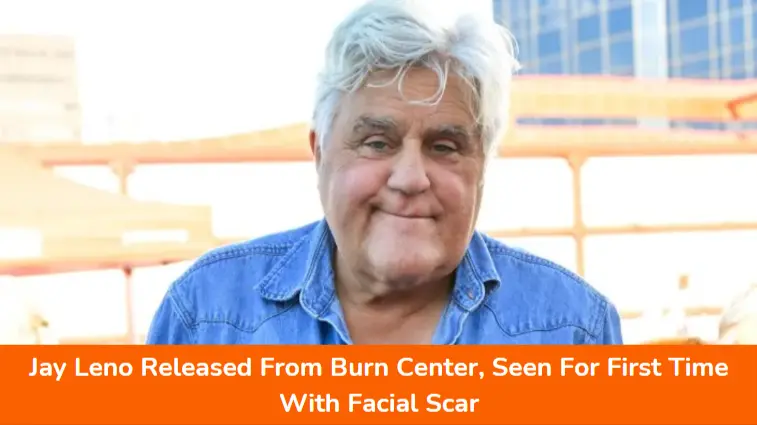 Jay Leno Released From Burn Center, Seen For First Time With Facial Scar