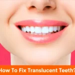 How To Fix Translucent Teeth?