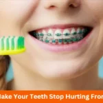 How to Make Your Teeth Stop Hurting From Braces