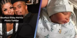 Blueface Baby Hernia Photo Twitter